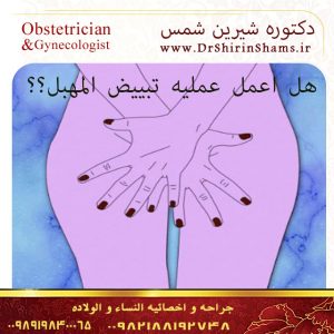 تبییض المهبل