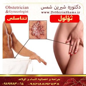 ثؤلول التناسلية hpv