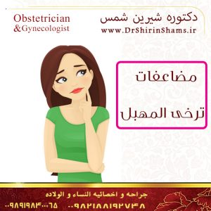 علاج تدلی المهبل
