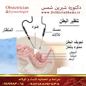 تنظیر البطن