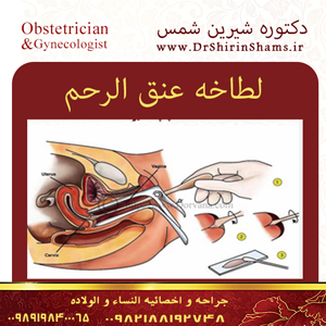 اختبار لطاخه عنق الرحم